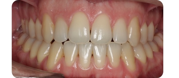 Ortodoncia 3